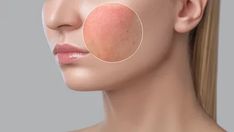 Pentingnya Skin Barrier (Foto/Pinterest)